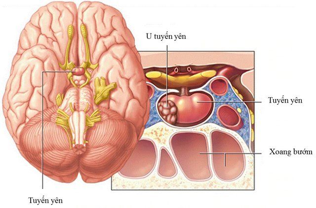 Đau đầu, đau buốt ở tay, chân và to lên bất thường… cảnh giác với bệnh to đầu chi - Ảnh 3.